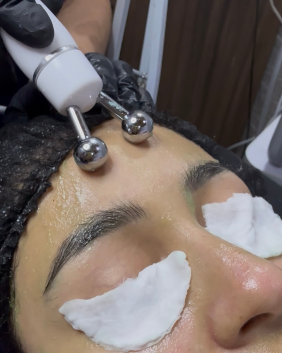 Estética facial